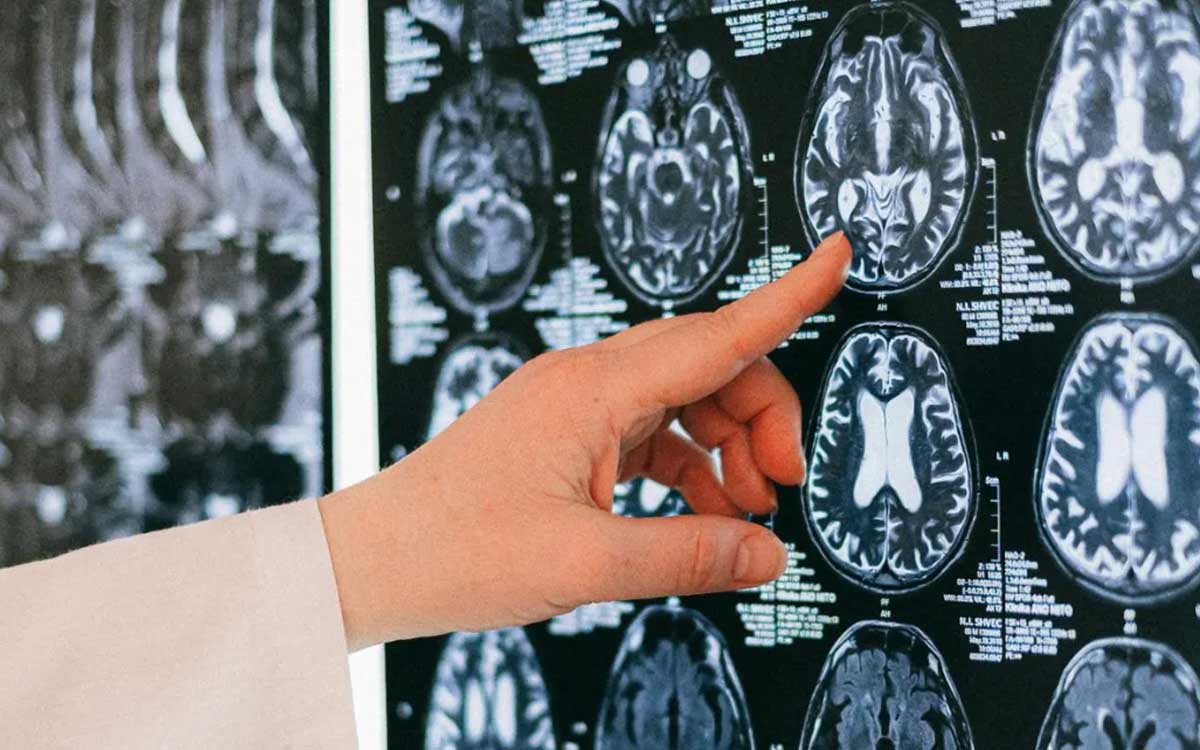 Uso de teléfonos móviles y cáncer cerebral: ¿mito o realidad según la OMS?